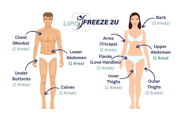 Areas you can have fat freezing treatment East Grinstead