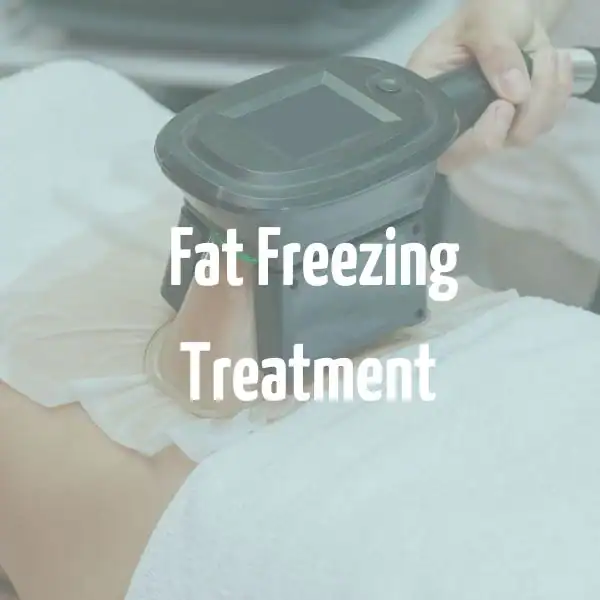 fat freezing treatment East Grinstead