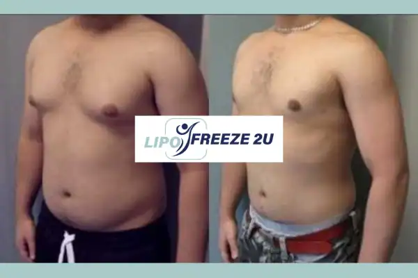 How Long Does It Take to See Results East Grinstead?
