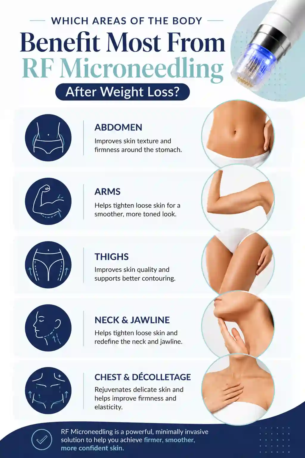 Which Areas of the Body Benefit Most From RF Microneedling After Weight Loss East Grinstead